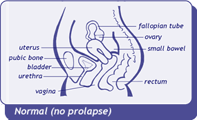 diagram of normal pelvic organ positions